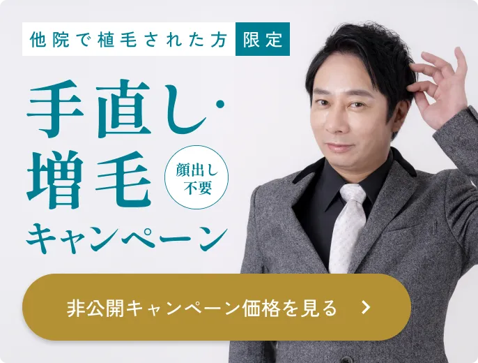 キャンペーンバナー