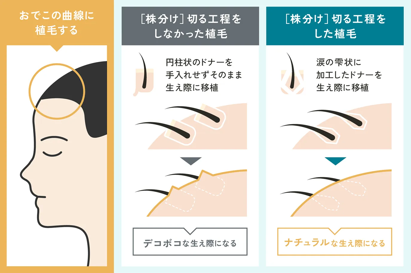 株分け切る工程説明画像