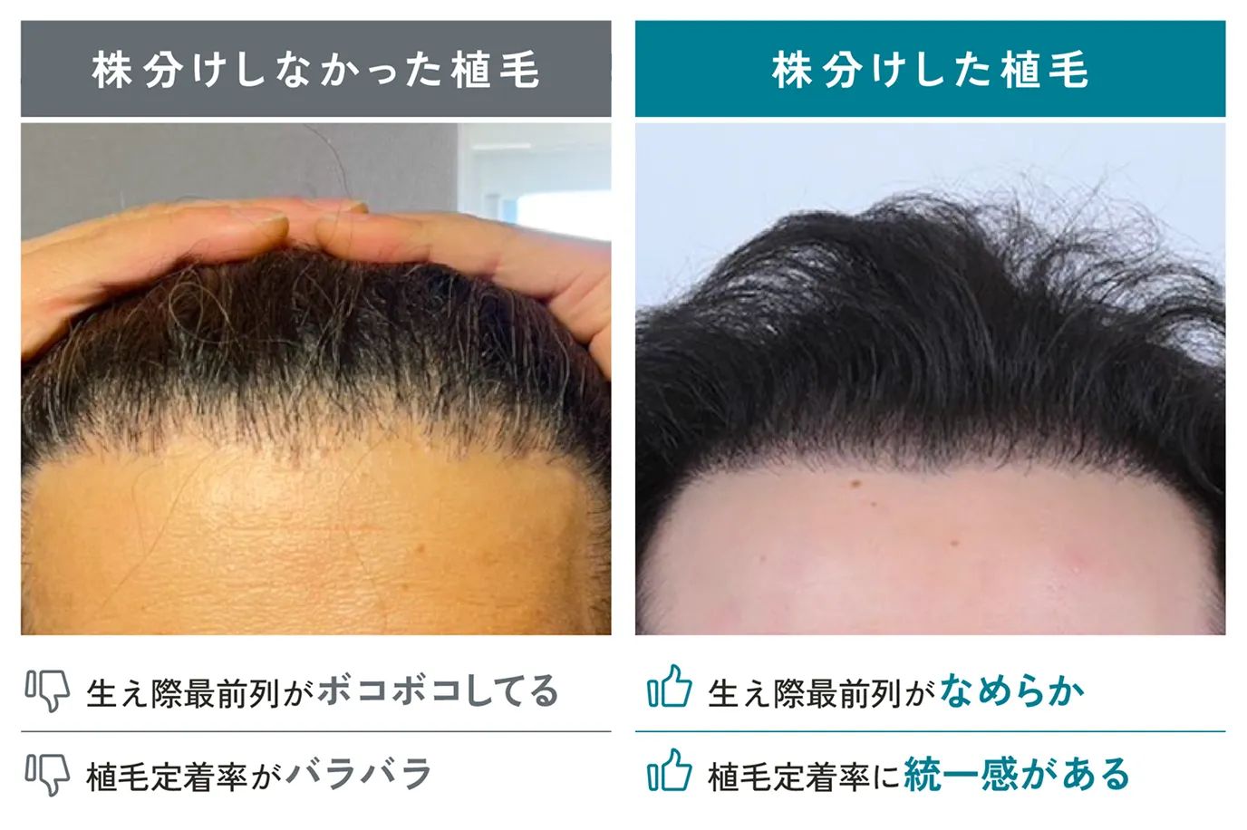 株分け比較画像