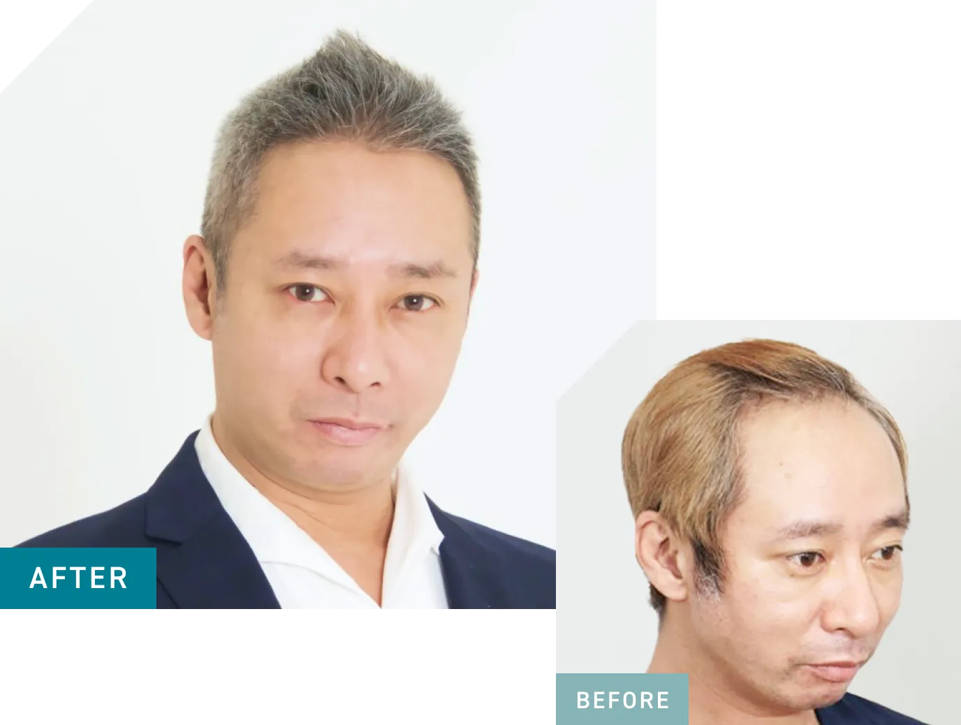 Before After画像