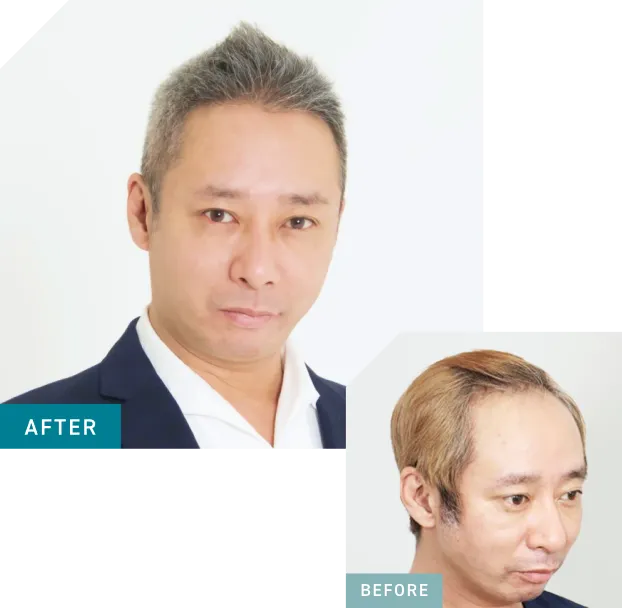 Before After画像