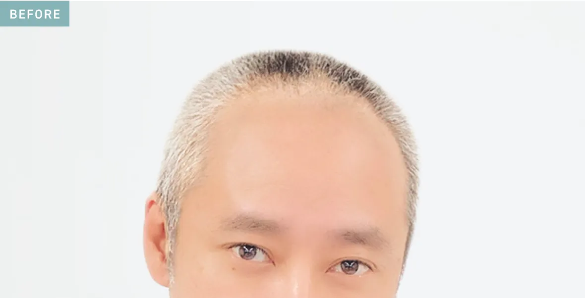 Before