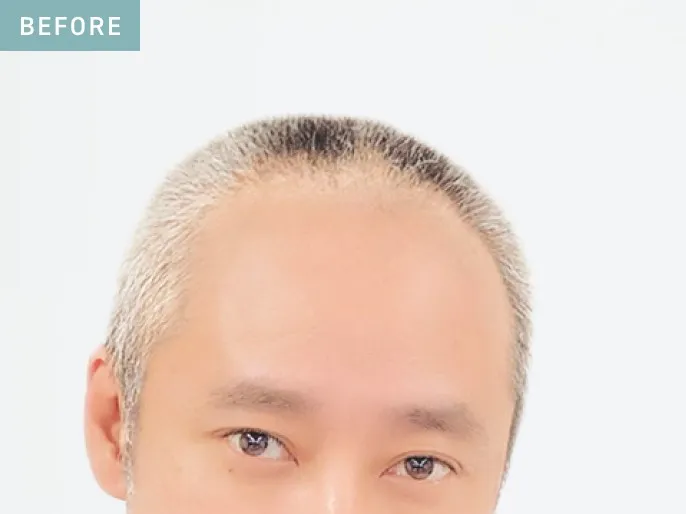 Before