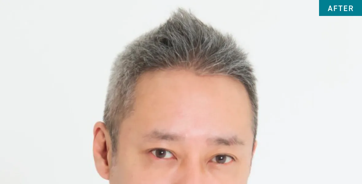 After