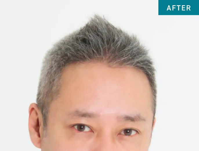 After