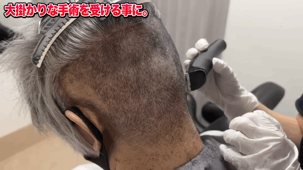 オペ室でドナー採取・株分け（株磨き）作業