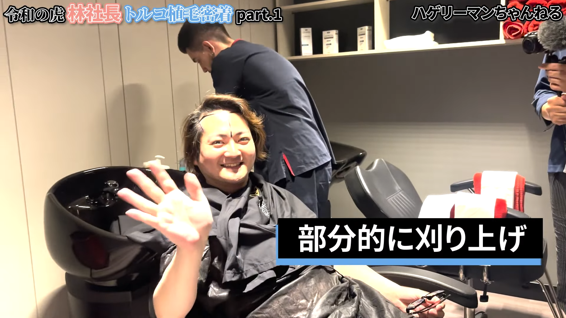 植毛部位とドナー採取部の刈り上げ