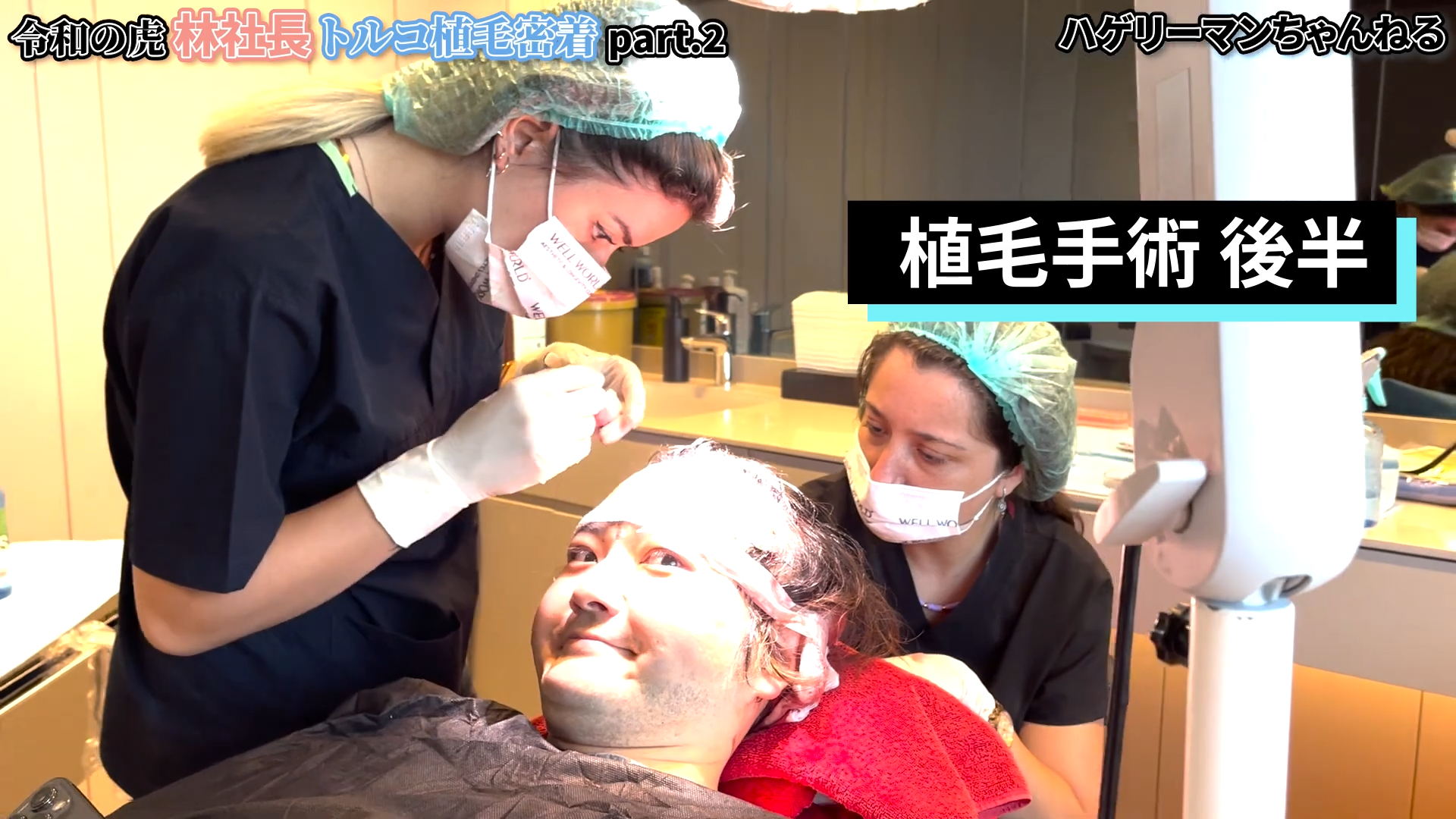 植毛施術再開｜植毛部位に毛を埋めていく
