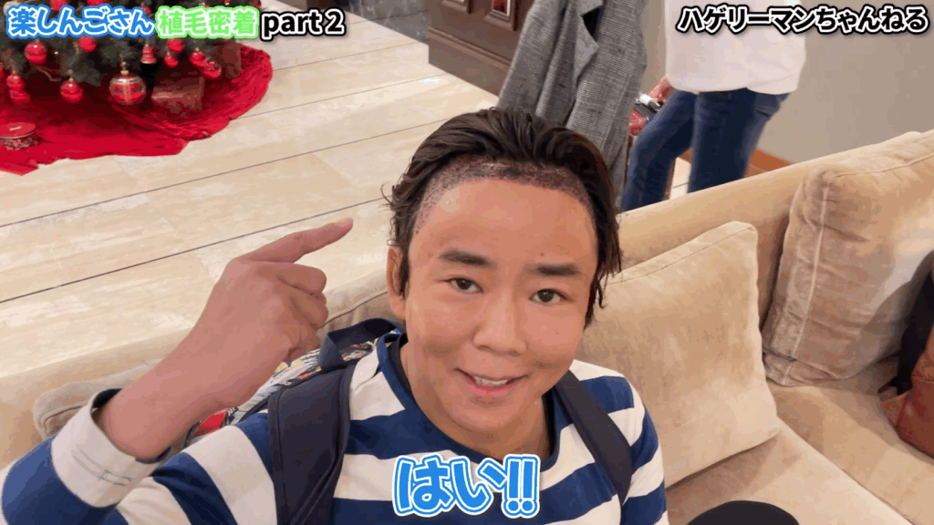 楽しんごさんの植毛施術後から翌日の様子