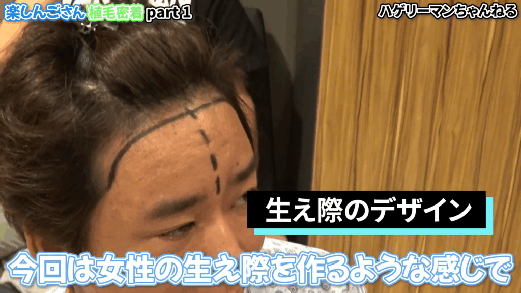 楽しんごさんの「美容植毛」計画｜施術前検査とデザイン決め