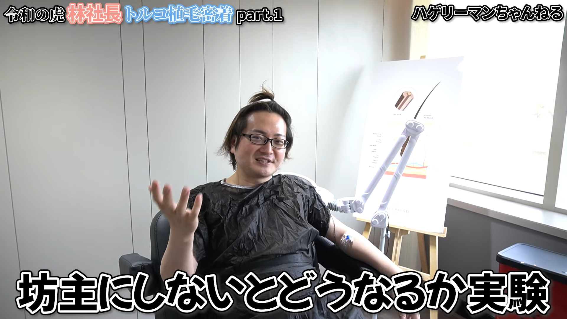 林社長の植毛施術前の様子