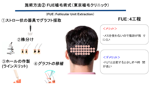 植毛における株分け（株磨き）とは？