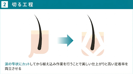 株の余分な皮脂や皮膚をカットする