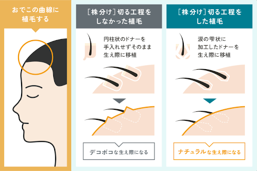 株分け（株磨き）をしないとどうなる？