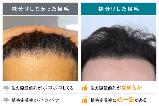 株分け（株磨き）をしなかった事例