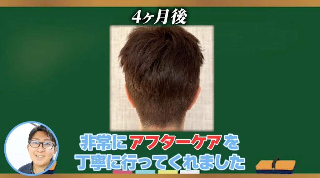 移植毛を守り抜く「究極のアフターケア」