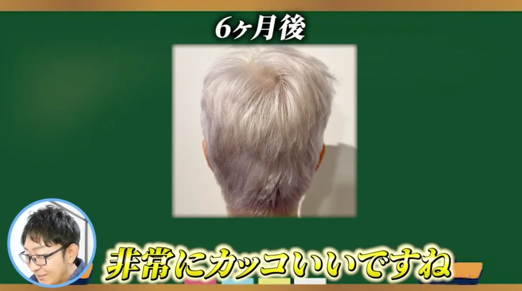 美容整形ちゃんが手に入れた自信と思い通りのヘアスタイル