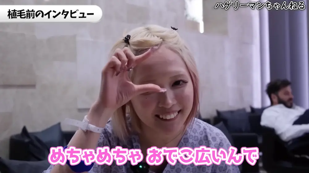 ハウスダストさんが植毛を決意した理由