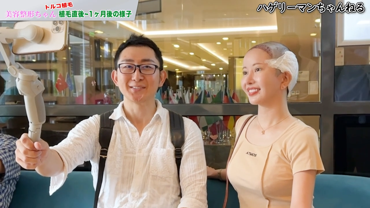 美容整形ちゃんの植毛施術直後の状態