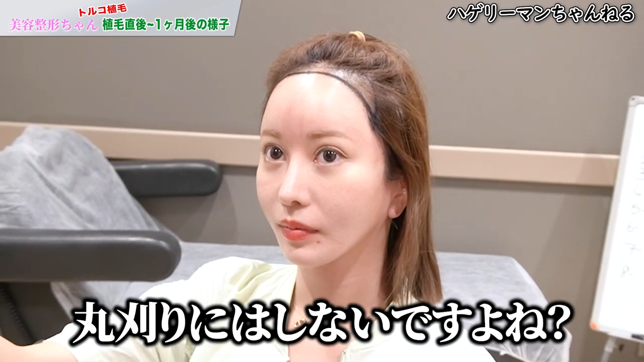 「いろんな髪型を楽しみたい」と丸坊主での植毛を決断！