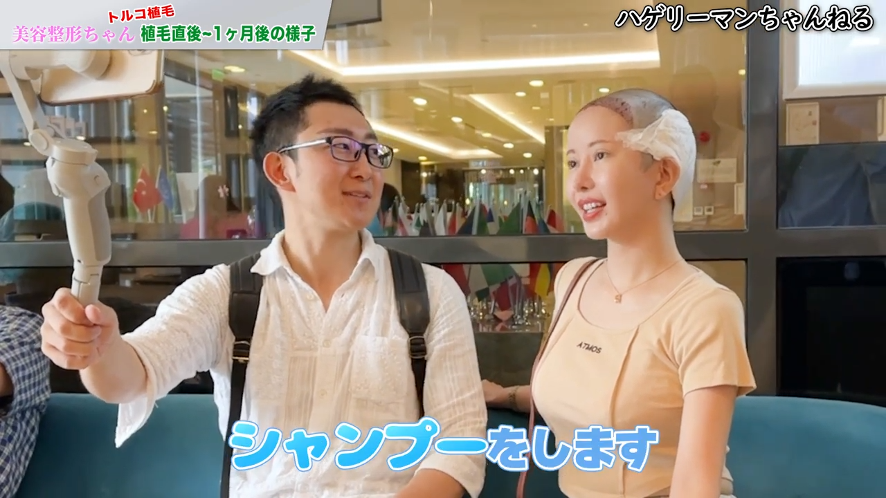 植毛後のシャンプーと注意点