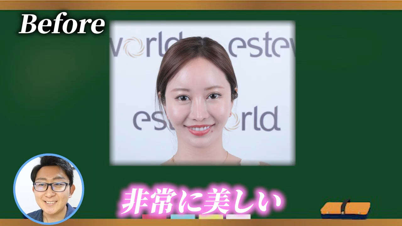 美容整形ちゃんが植毛を決意した理由とは？