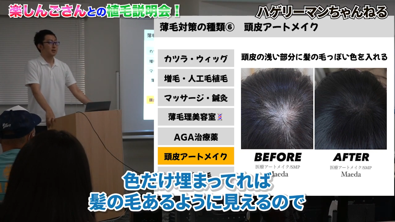 色で髪があるように見せる最新アプローチ「頭皮アートメイク」とは？