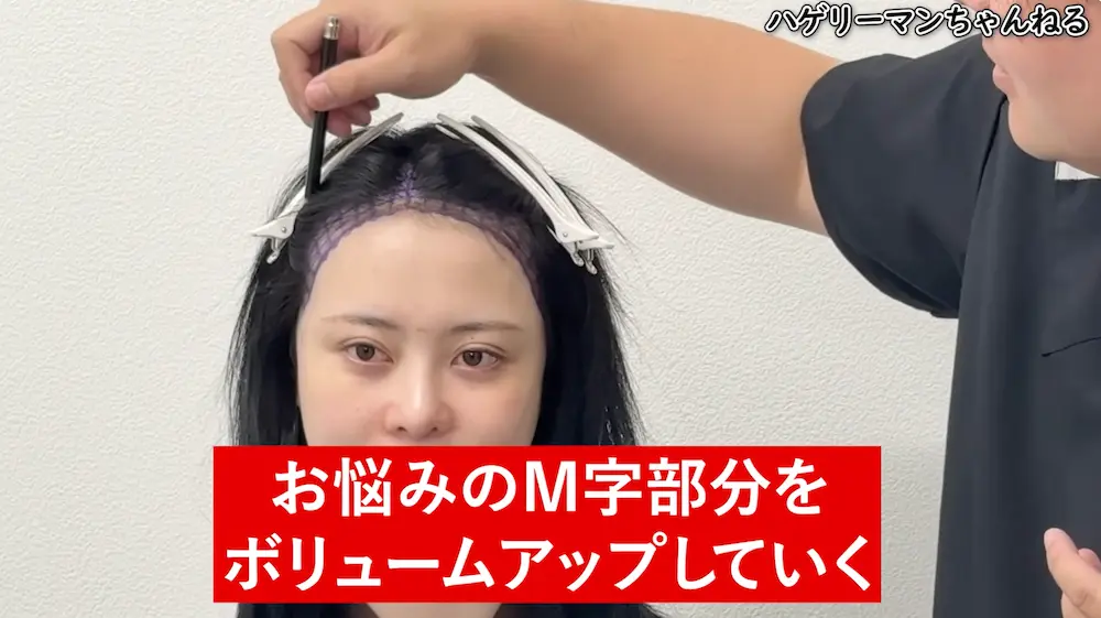 レイさんが生え際デザインで重視したポイント
