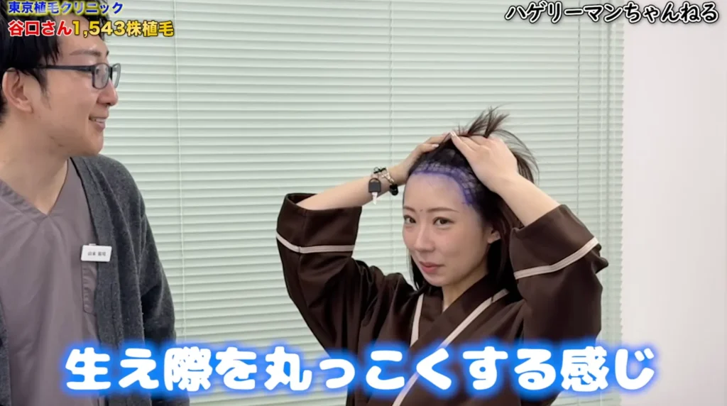 なぜ女性の「美容植毛」が注目されているのか?