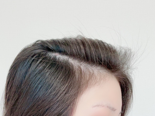 女性の薄毛が目立たない髪型|分け目