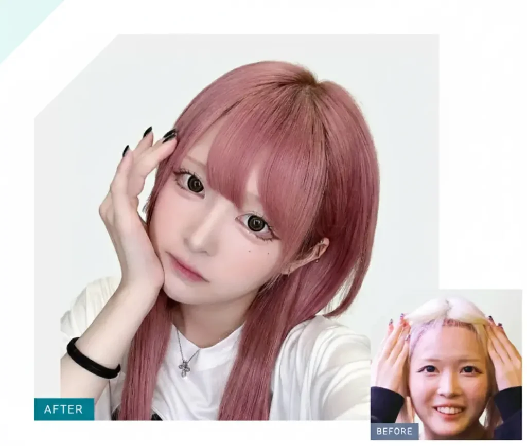 ハウスダストさん:若年層も注目する「デザイン性」重視の植毛