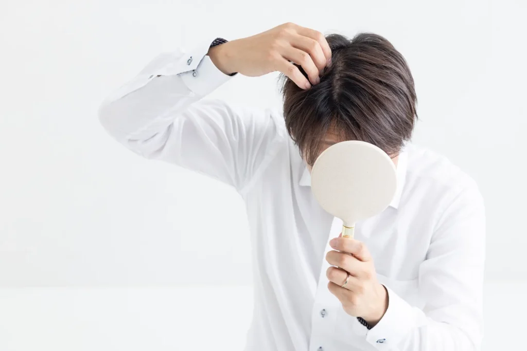 芸能人の事例からトルコ植毛を検討する際によくある質問