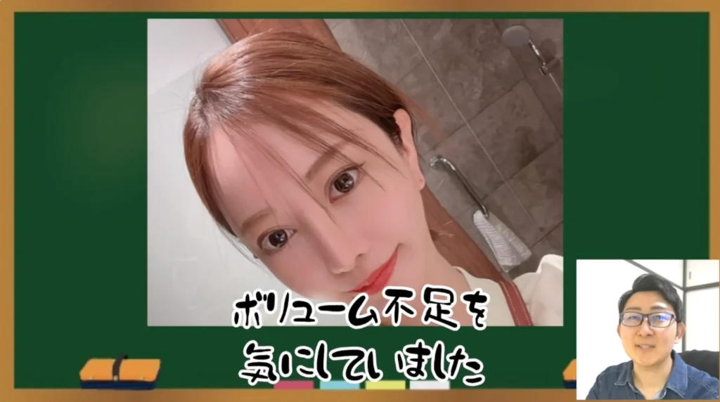 なぜ「美容整形ちゃん」は自毛植毛を選んだのか?