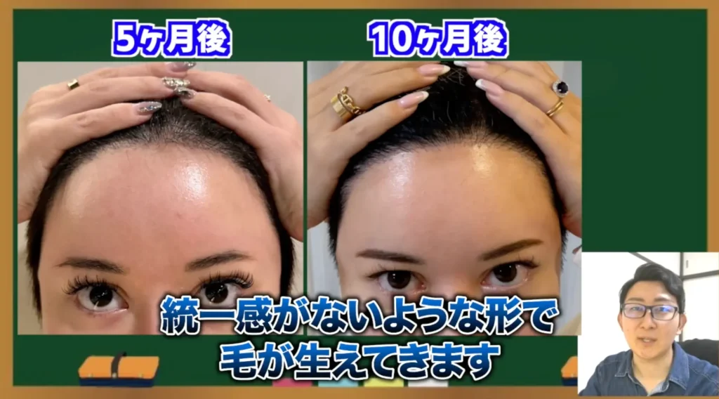 半年〜9ヶ月:毛質の変化と「ゴワつき」への対処