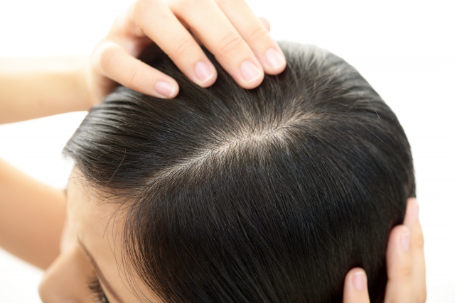 女性の薄毛が目立たない髪型|つむじ・頭頂部