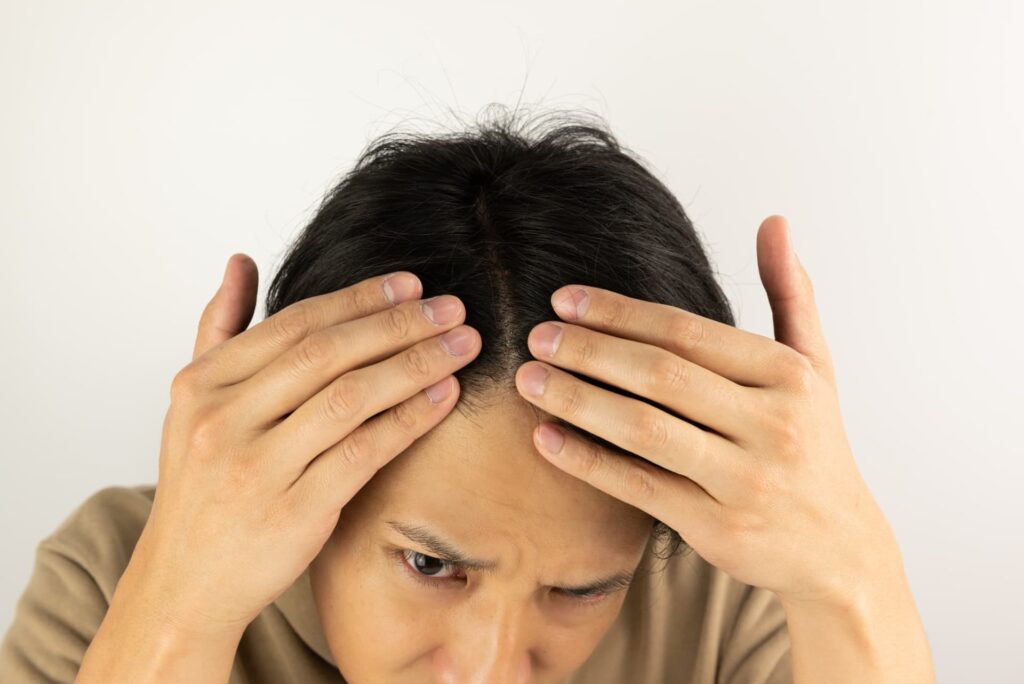 トルコ植毛の密度とは?自然な仕上がりに必要な株数の目安