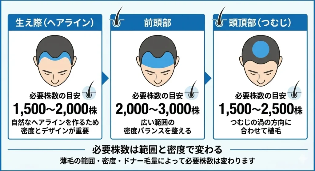生え際(ヘアライン)、前頭部、頭頂部(つむじ)部分それぞれの必要株数の目安を説明した図
