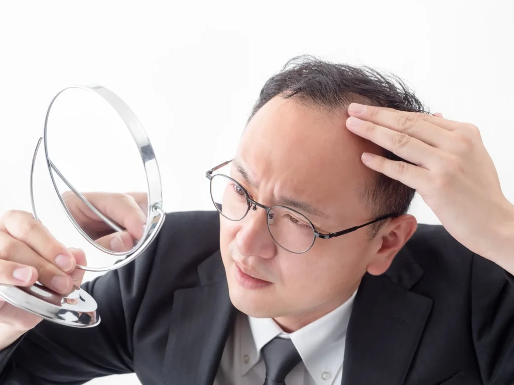 自毛植毛のFUE法・OHT法・DHI法とは?