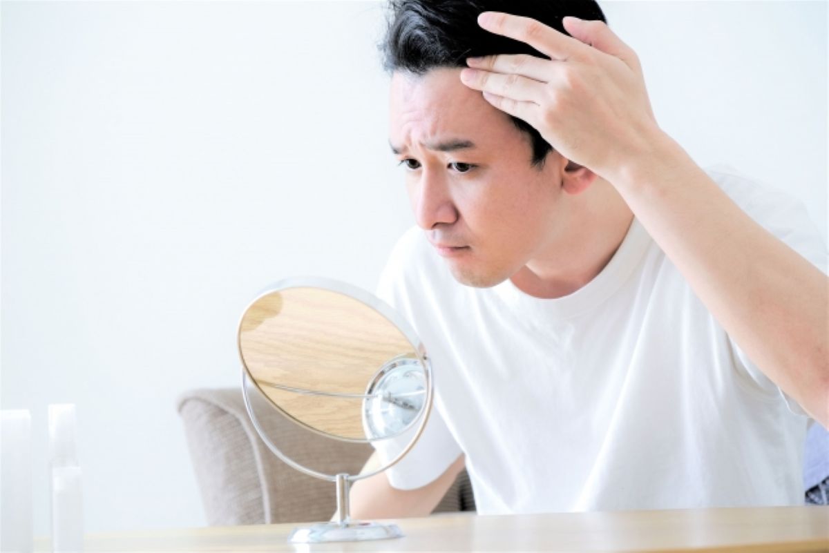 自毛植毛は一生モノ？10年後の経過とAGA進行から見る後悔しないためのポイント