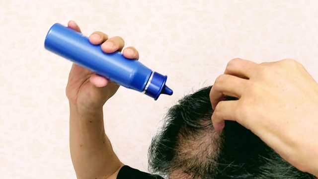 髪型だけではカバーしきれない薄毛への対策