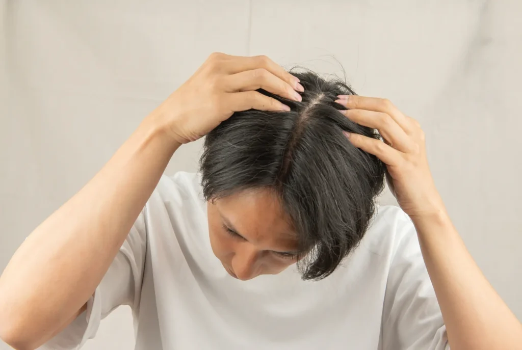 【注意】薄毛にパーマをかけるリスク｜頭皮・毛髪へのダメージ