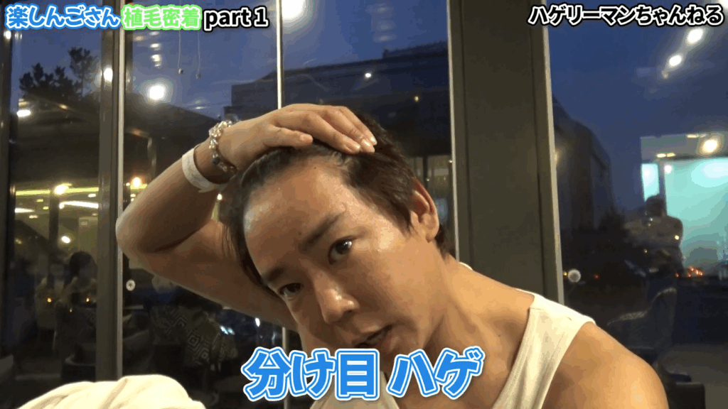 薄毛の悩みを語る楽しんごさん