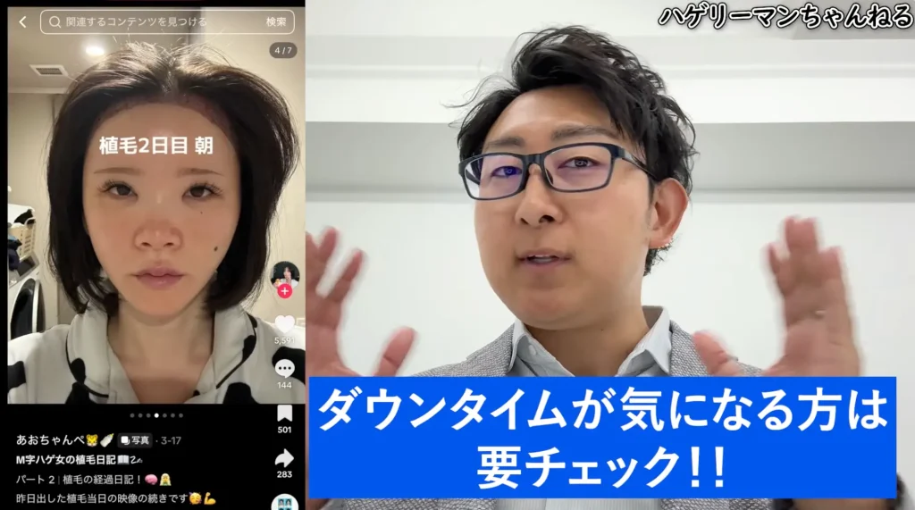 1年後の仕上がりを決める!動画で話題の「術後セルフケア」