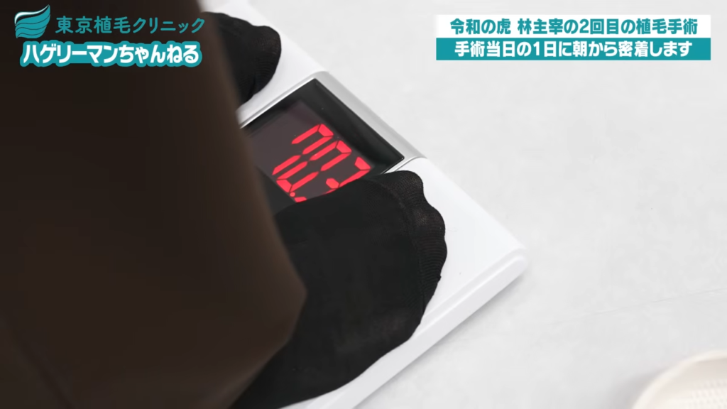 施術の前準備｜体重測定・麻酔
