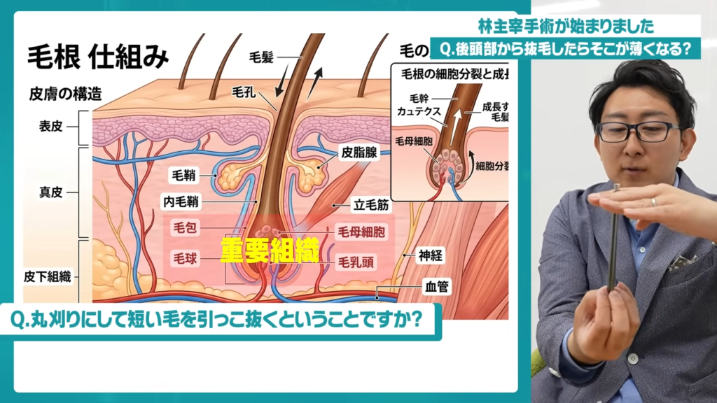 施術前半｜後頭部から毛根を採取