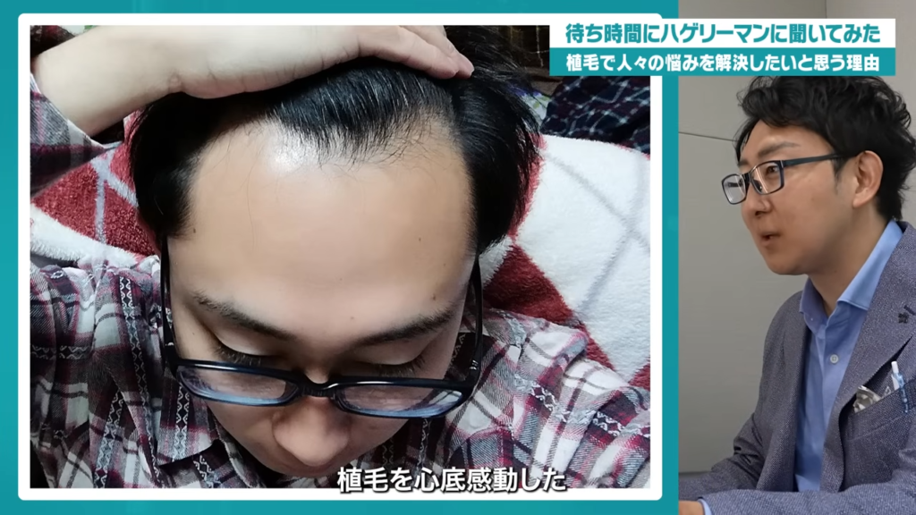 海外植毛を経験して感じた違い